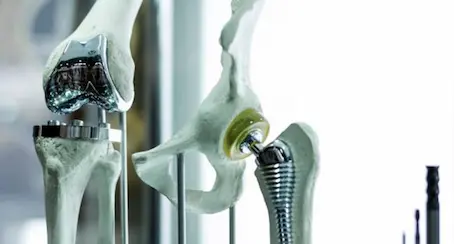Protesis de cadera y rodilla